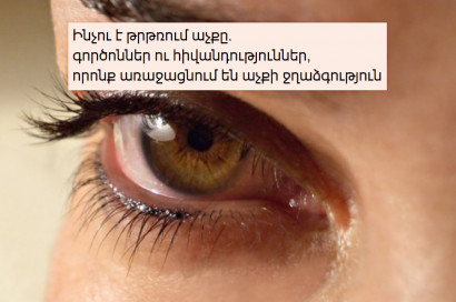 Ինչու է թրթռում աչքը գործոններ ու հիվանդություններ, որոնք առաջացնում են աչքի ջղաձգություն