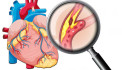 Cholesterol Levels: What Does High or Low Cholesterol Mean?